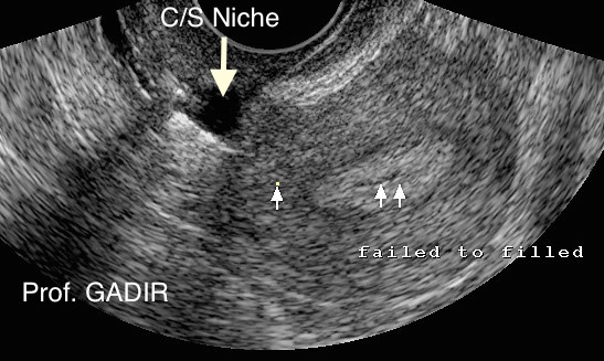 CS_Niche_2