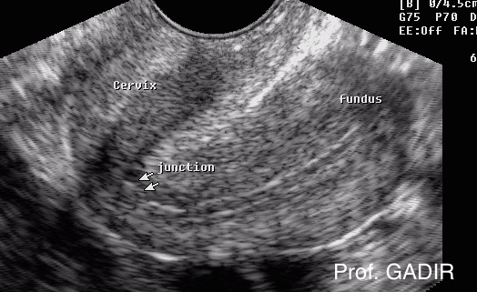 Cochleate_uterus_Cecilica_copy